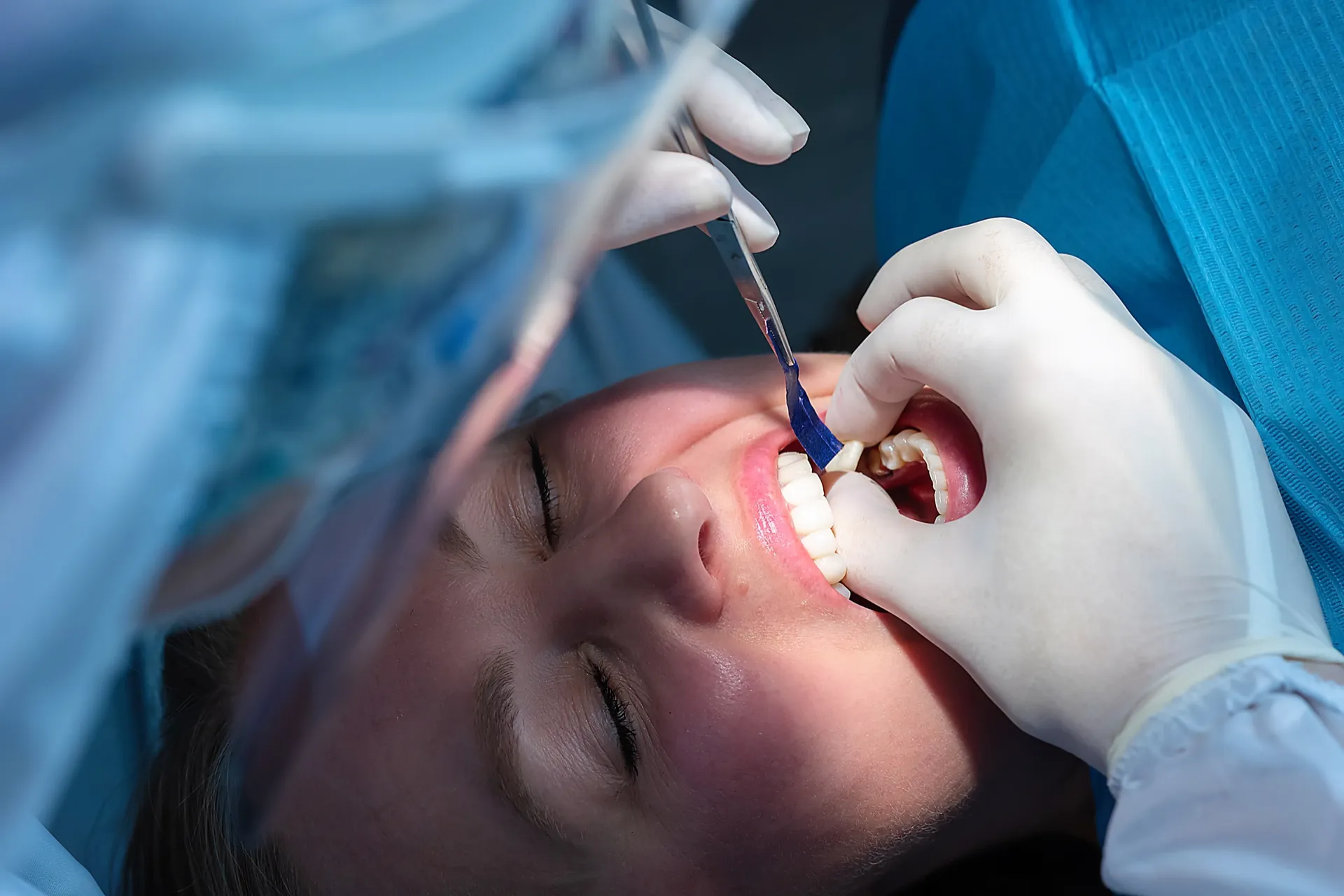 Dental crowns procedure
